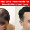 What Causes Hair Loss and What Supplement Will Stop it?