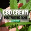 CBD Cream for Treating Acne and Other Anti-Aging Tips