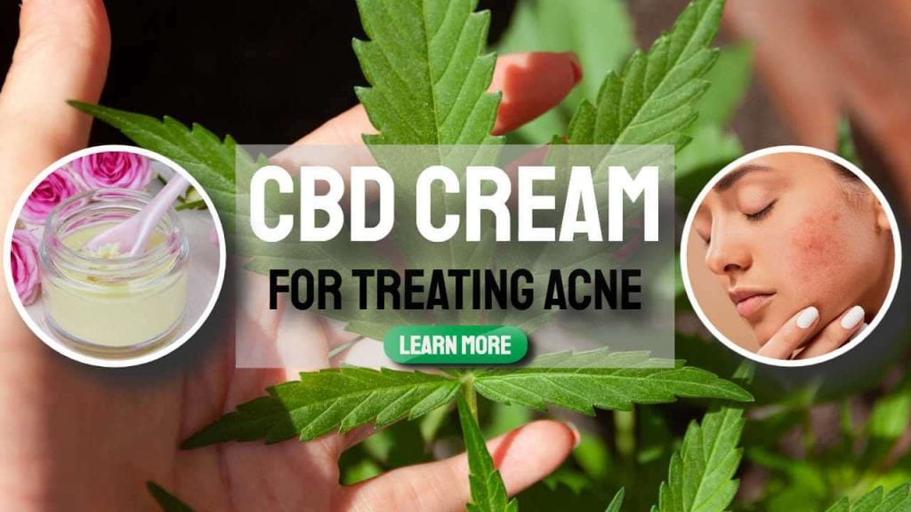cbd cream for treating acne