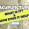 What Exactly is Acupuncture and How Does Acupuncture Work?