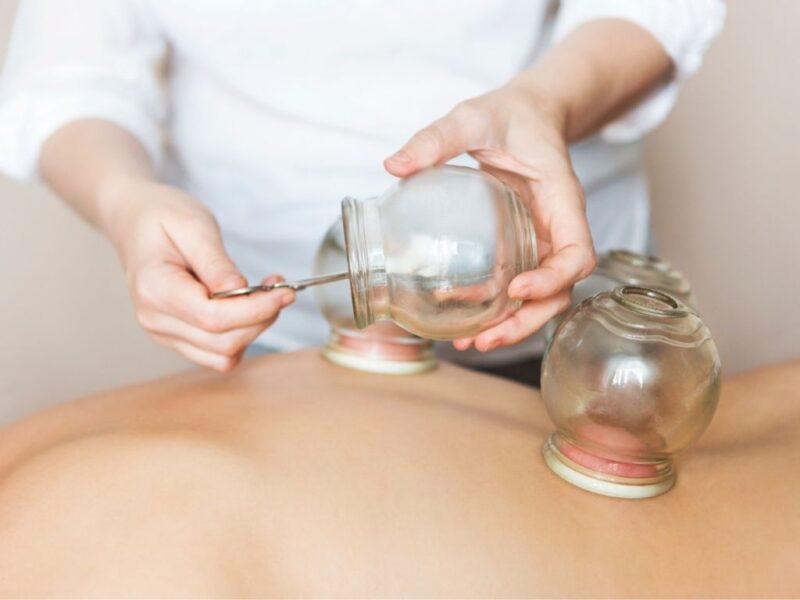 Cupping therapy near me