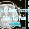 How Do Brain Tumours Cause Ear Pain – Including Aneurysms