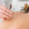 Can Acupuncture Help During Pregnancy? Yes, It Can!