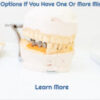 Learn Your Options If You Have One Or More Missing Teeth