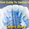 A Definitive Guide To Dental Implant Surgery