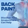 Acupuncture: A Safe and Effective Way to Treat Sciatic Pain