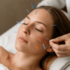Cosmetic Acupuncture: Key Disadvantages You Should Consider